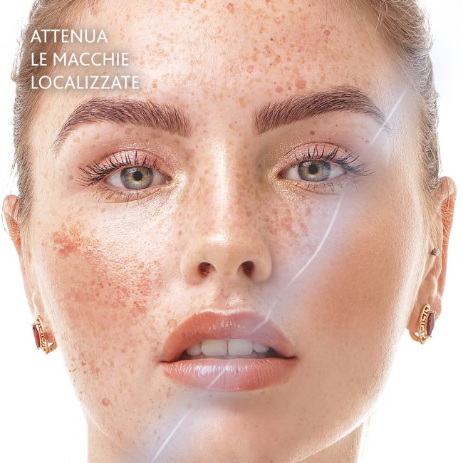 ESTHE-WHITE - Targeted Dark Spots Concentrate